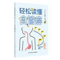 轻松读懂食管癌